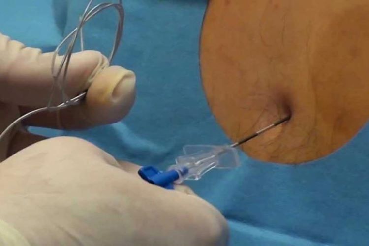 تزریق در کلینیک درد